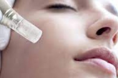 Microneedling Results