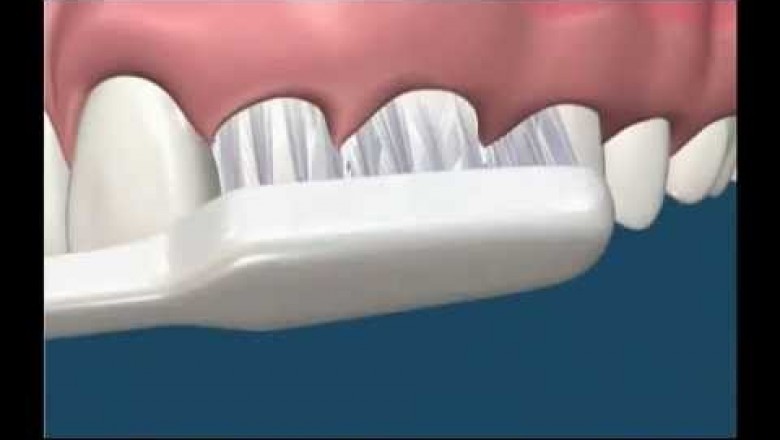 Modified Bass Tooth Brushing Technique