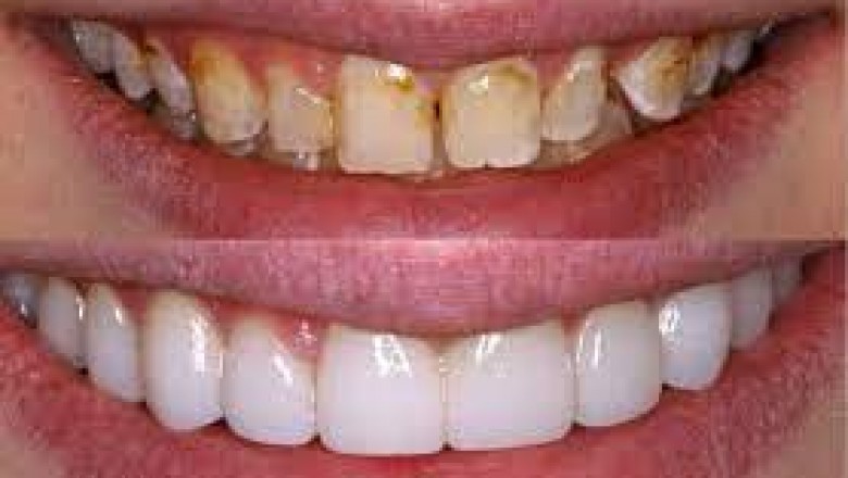 Find The Best Dentist in Houston TX