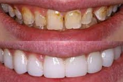 Find The Best Dentist in Houston TX