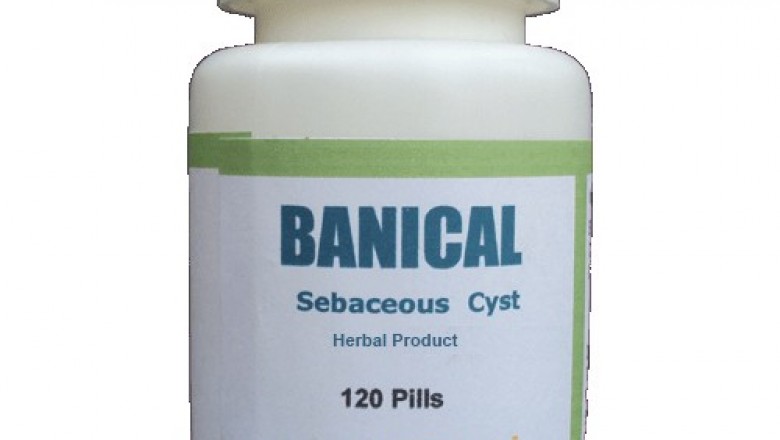 Treatment for Sebaceous Cyst | Remedies | Herbal Care Products