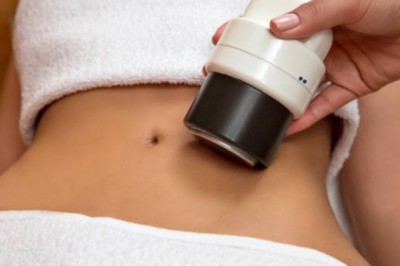 Coolsculpting Downtime