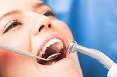 Why Do I Need Dental Veneers?