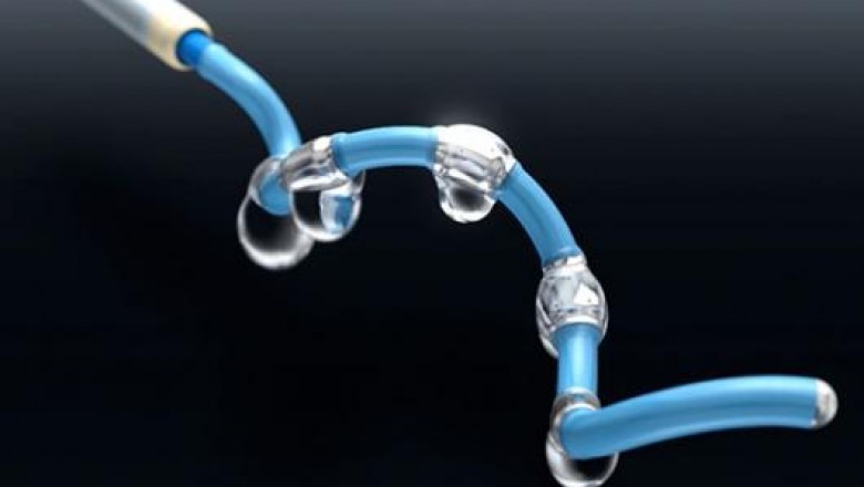 With Medtronic plc announcing the first-ever clinical data from the SPYRAL HTN-OFF MED Pivotal Trial for denervation surgery, the Renal Denervation Devices Market is gaining traction.