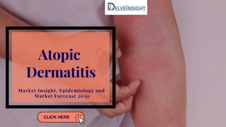What is Atopic Dermatitis?