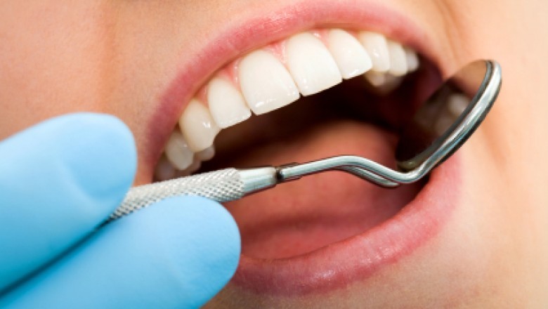 Tooth Colored Fillings in Nokomis | Dr. Keith Blessitt