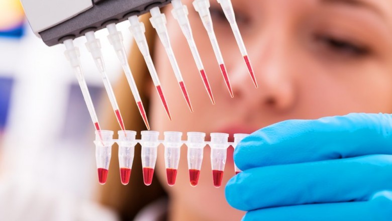 The epidermolysis bullosa therapeutics is dependent on the severity of the disease and might include simple topical medications as well as surgery.