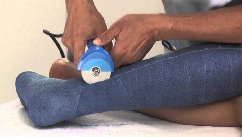 Cast saw devices have some advantages such as high cutting performance, extremely durability, less procedure, and easy to use