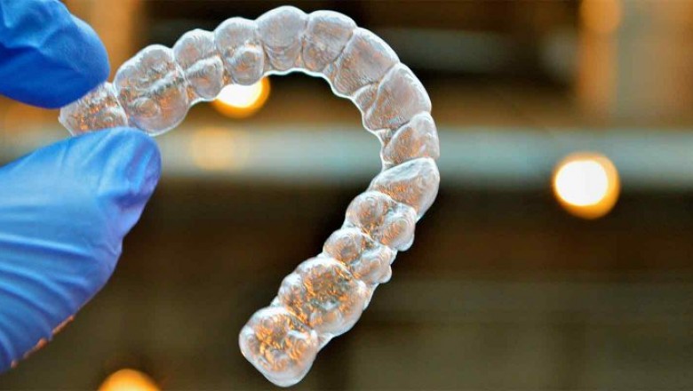 Invisalign vs braces: What you should consider in 2021?