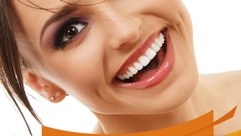 Best Dental Veneers in Hyderabad | Best Dental Veneers in India