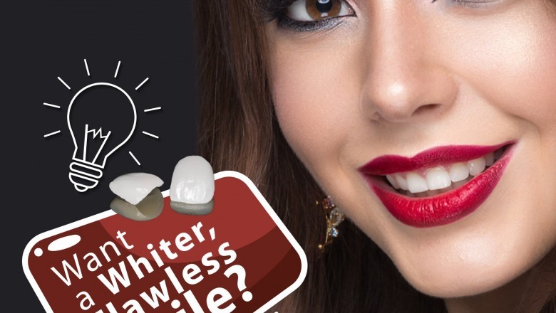 Tooth Whitening In Secunderabad | Tooth Bleaching In Secunderabad