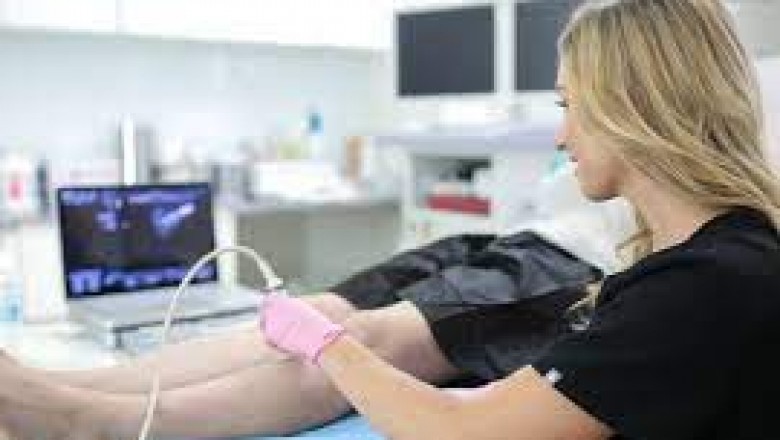 Spider Vein Treatment: Five Active Ingredients In A Good Spider Vein Removal Cream.