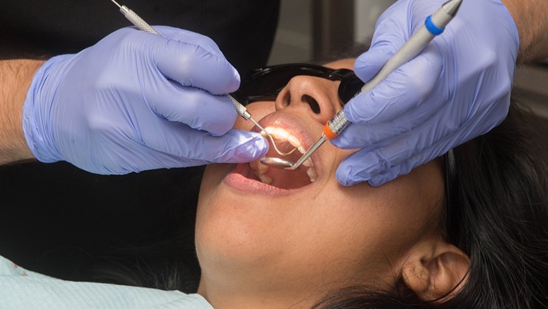 Wisdom Teeth Removal Why, How, and When?