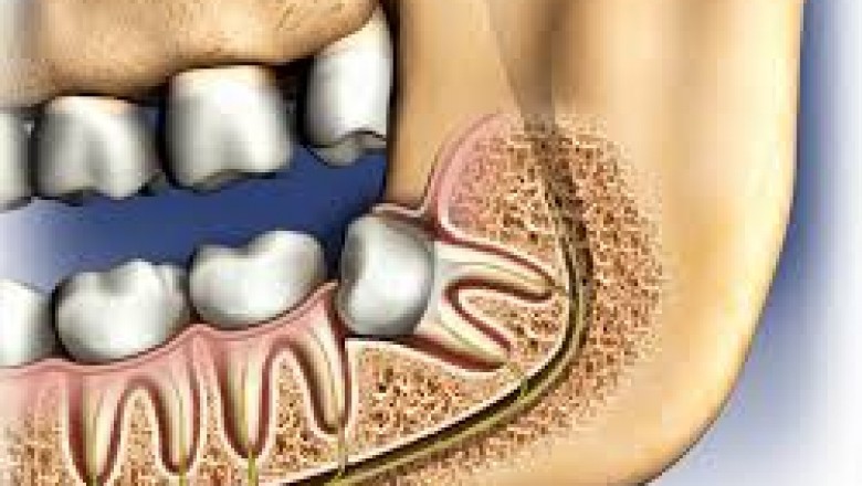 What to do During a Tooth Infection?