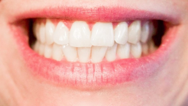 What to keep in mind when choosing dental insurance?