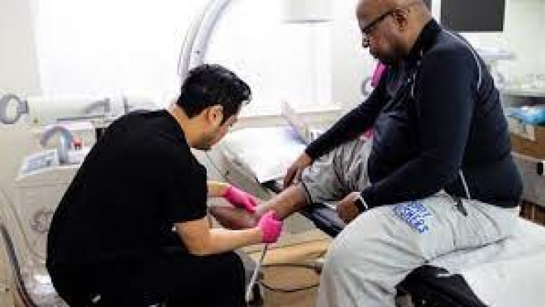 Woodland Park Spider Vein Treatment Near Me