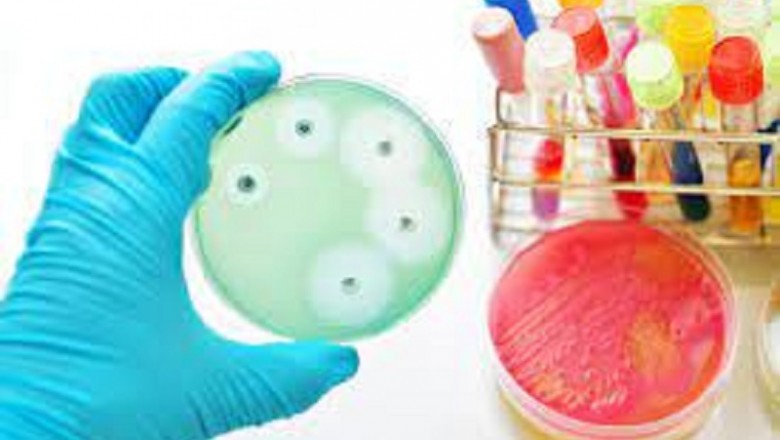 Antimicrobial Susceptibility Testing Business research report by DBMR | BD, Synbiosis, Zhuhai DL Biotech Co., Ltd, Mast Group Ltd