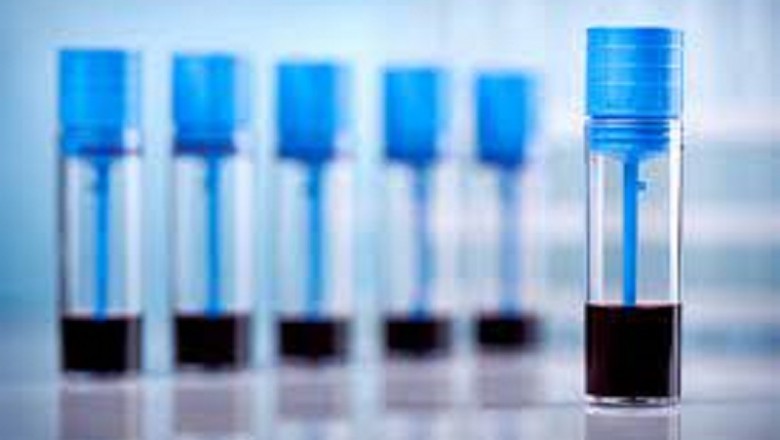 Point-of-Care Testing (POCT) Market Analysis, Demand, Strategies, Forecast  to 2028 including covid19 Impact | AccuBioTech Co., Ltd., ACON Laboratories, Inc., Acrongenomics Inc., bioMérieux SA, Biomerica, Inc