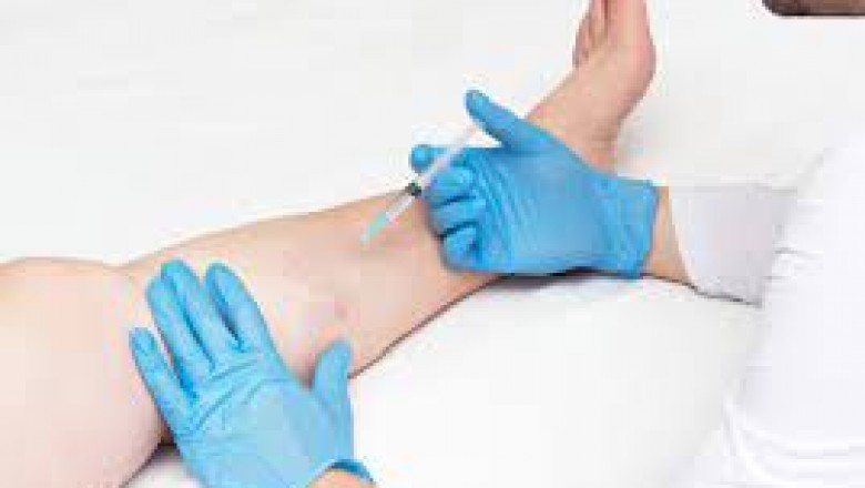 What are the 7 Tips For Choosing A Vein Specialist?
