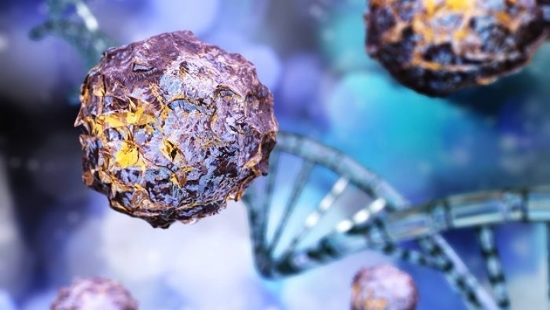 Cutaneous Squamous Cell Carcinomas Treatable Using Radiation Therapy