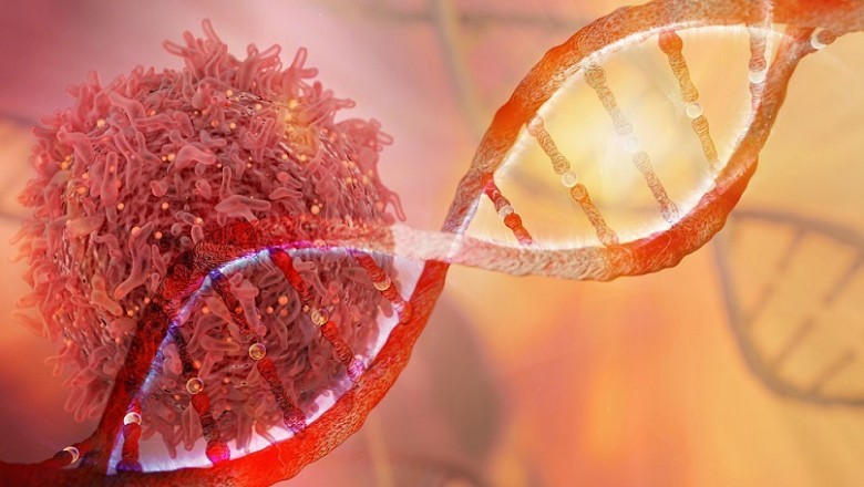 The only solid tumor treatment for different cancer types can often be surgery