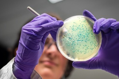 15 Ways To Introduce Gram Positive Bacterial Infections Market.