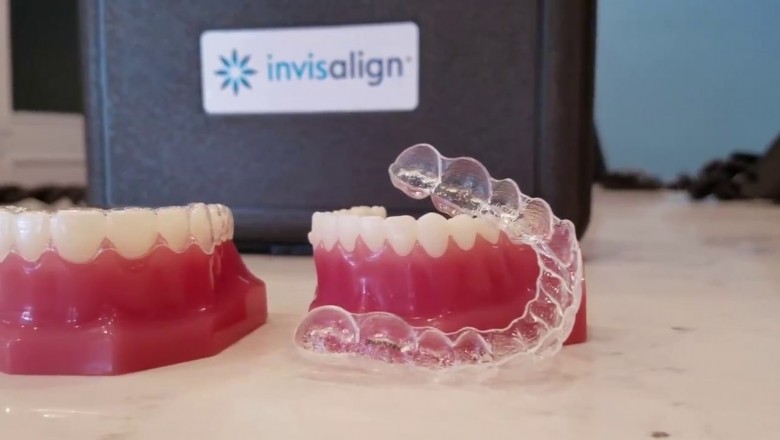 Why Do You Need to Visit the Best Reviewed Dentist in Pinecrest?