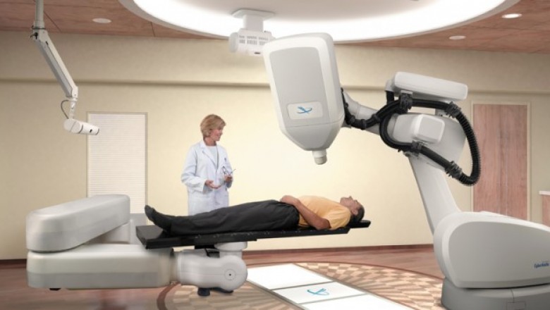 5 advantages Of CyberKnife That May Change Your Perspective.