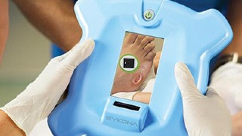 Digital Wound Measurement Devices Market Expansion Projected To Gain An Uptick During 2027