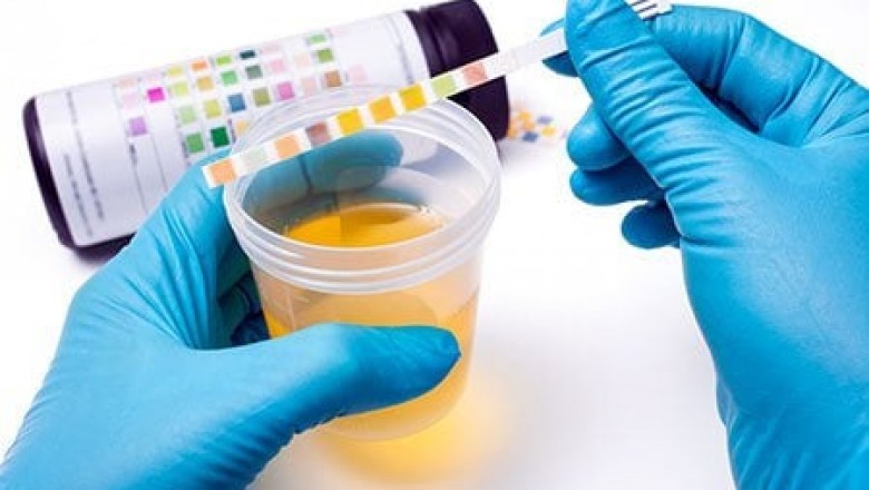 Global Urinalysis Market by Player, Region, Type, Application and Sales Channel 2021-2030