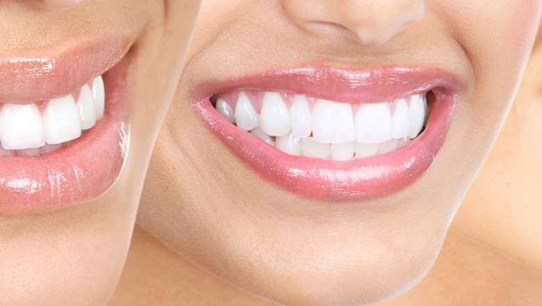 Maintain Your Smile with Regular Dental Check-Ups