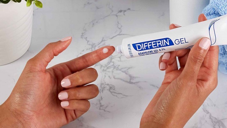 Adapalene products are known to be both safe and effective in the long-term treatment of acne.