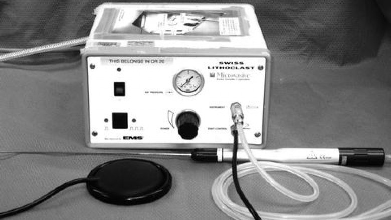 Global Ultrasonic Lithotripsy Device Market Research Report 2021-2025