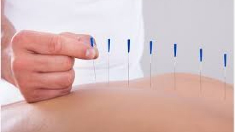 How Acupuncture Can Help With Infertilty