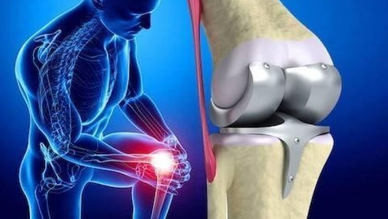 New technologies are being introduced into the global artificial joints market, which is expected to increase the efficiency of joint replacement surgeries.