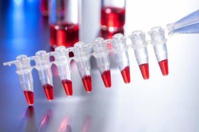 Fibrinogen concentrates have become an important aspect of new therapeutic options for paediatric and adult patients with acute bleeding episodes