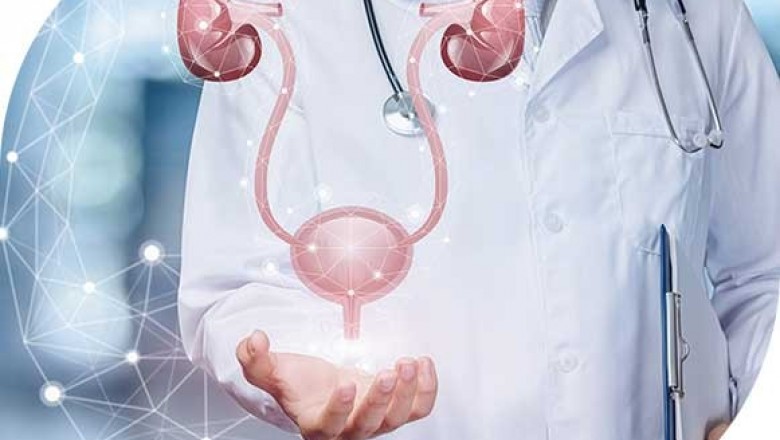 Best Kidney Stone Hospital In Bangalore