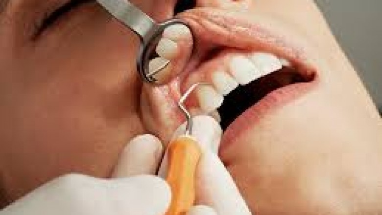 How to Get Over Your Fear of Dentists