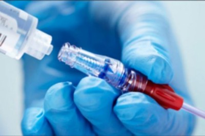 The Popularity Of Europe Needle-Free Iv Connectors Is Widespread Around The World. What Makes Them So Popular?