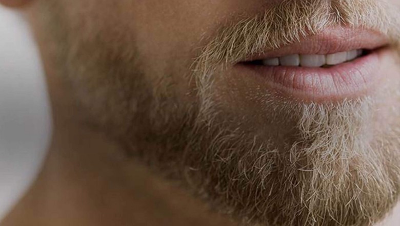 What is Beard Transplantation?