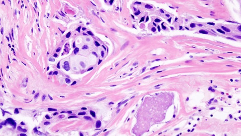 Anatomic Pathology is a branch of medicine that is mainly concerned with the diagnosis of an ailment