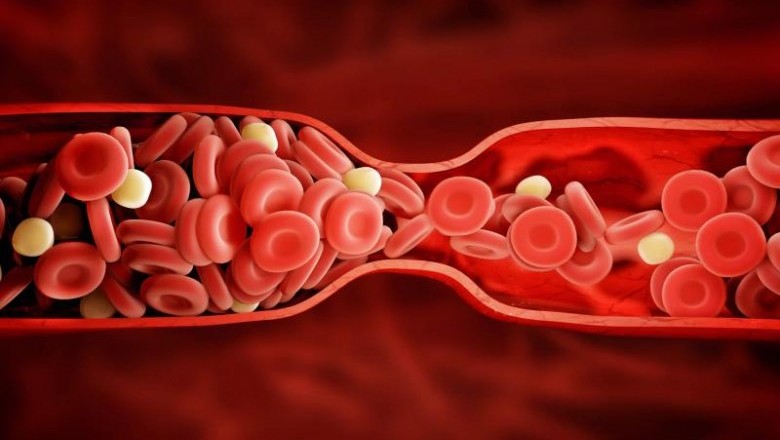 Blood Clotting Factors are involved in blood clotting and are responsible for several other health problems and difficulties as well