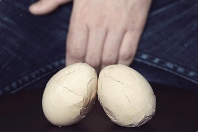 Hydrocele Treatment In Bangalore