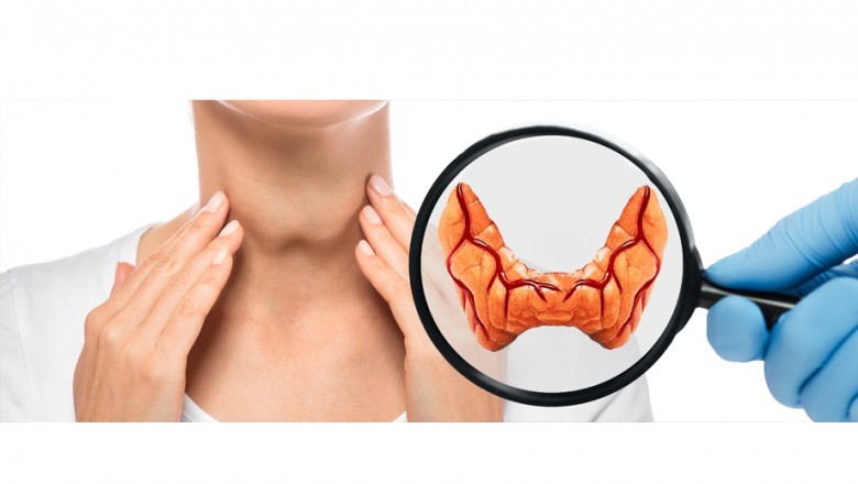 Natural Remedies To Cure Thyroid At Home