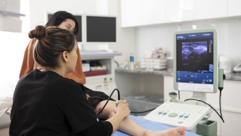 5 Signs When You Need to go to a Vein Specialist