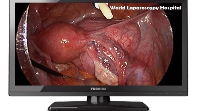Download Free Minimal Access Surgical Videos