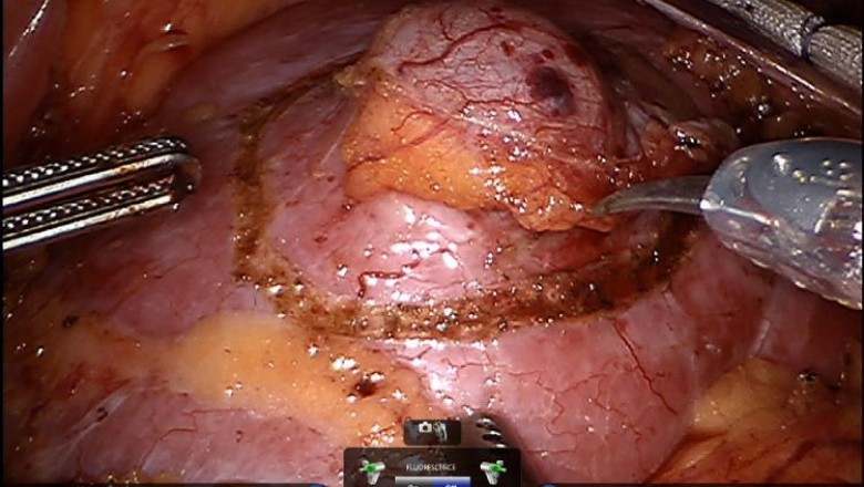 Laparoscopic Training Course For Surgeon, Gynecologist, Urologist and Pediatric Surgeon