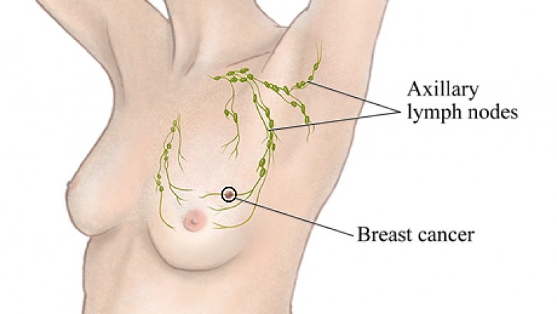 Breast Biopsy Market Expected to Showcase Extensive Growth, Business Opportunity | Industry Analysis | Johnson & Johnson, Galini SRL, Intact Medical Corporation, Conceptus INC, Hologic Inc., Karl Storz GmbH & Co. Kg, and GE