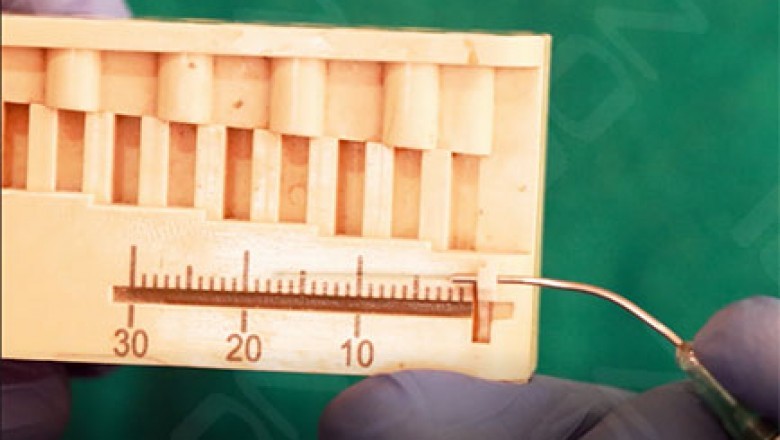 PHOTOACTIVATED DISINFECTION (PAD) FOR ROOT CANAL DISINFECTION USING LASER