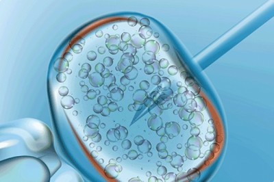 Best Infertility Hospital In Bangalore